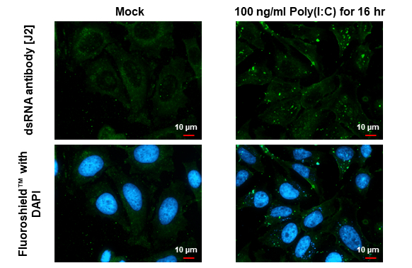 Anti-dsRNA antibody [J2] (GTX641519) | GeneTex